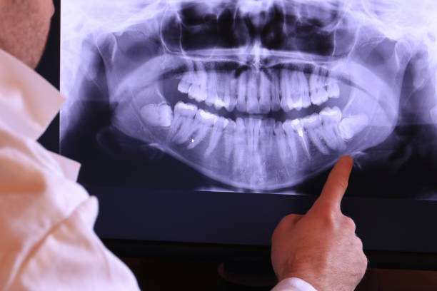 Best After-Hours Emergency Dentist in Pce, LA