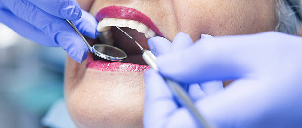 Best Emergency Treatment for Toothache in Pce, LA